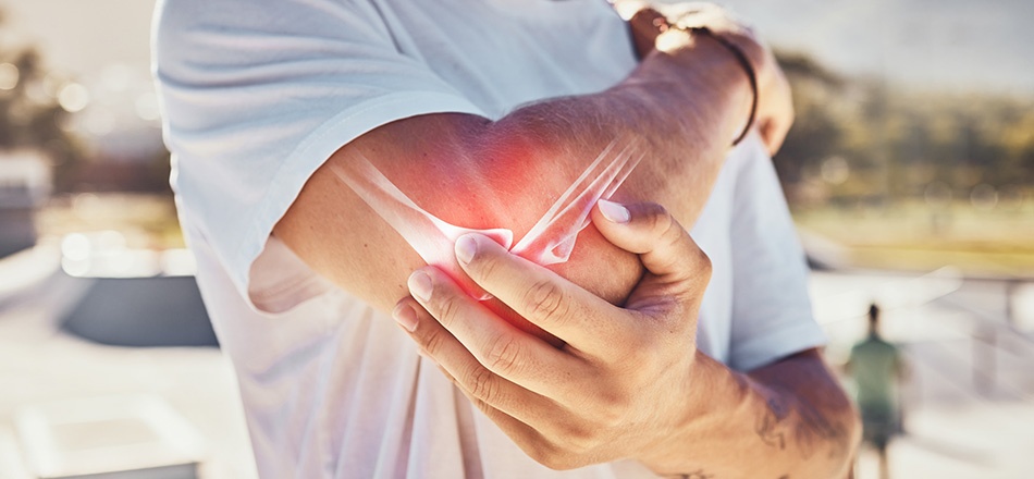 CBD et arthrose : le cannabidiol pour soigner la douleur