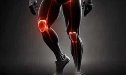 Le CBD : un allié potentiel contre l’arthrose